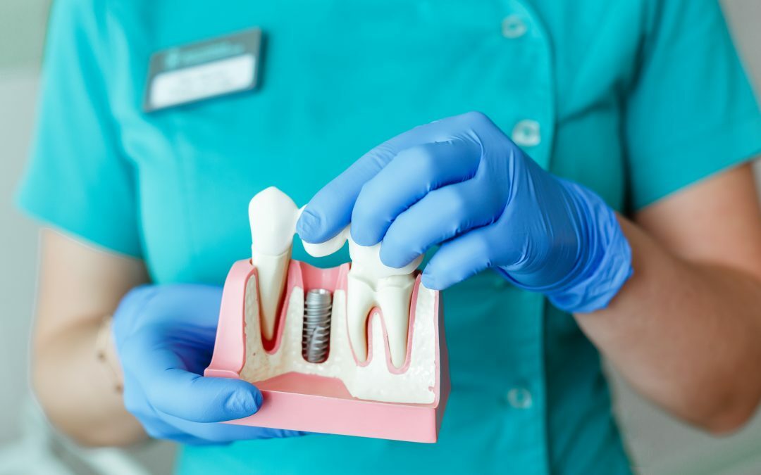 Lincoln NE oral surgery what are dental implants?