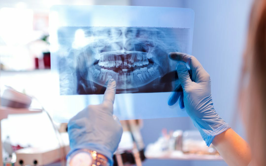 Considering Jaw Surgery? Risks of Jaw Surgery