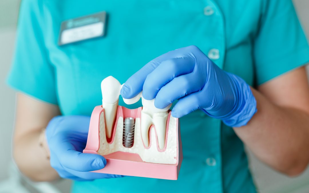 Dental Surgery: 5 Frequently Asked Questions About Oral Procedures