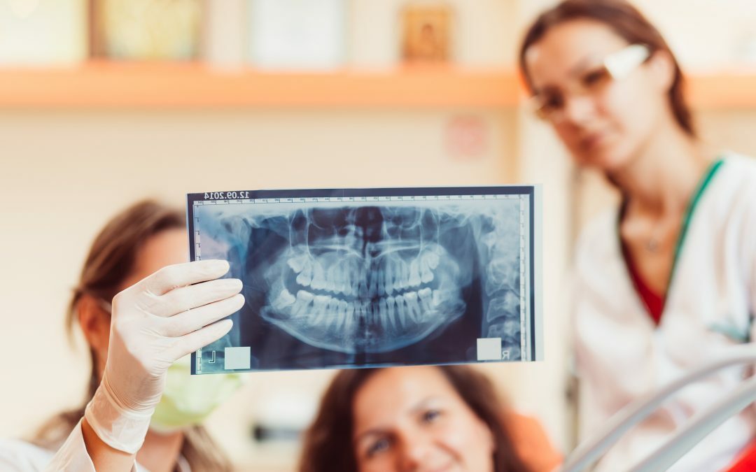 Dental Implants, Jaw Surgery, And Wisdom Teeth Removal